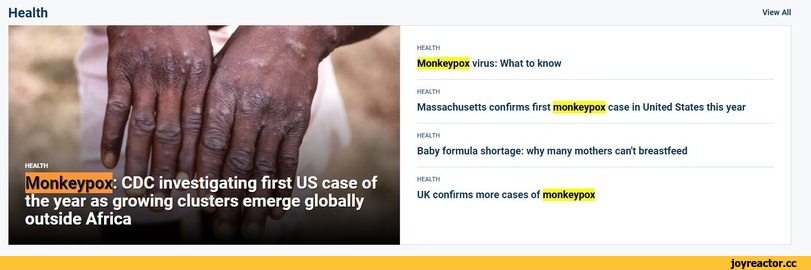 ﻿Health
CDC investigating first US case of the year as growing clusters emerge globally outside Africa
View All
HEALTH
Monkeypox virus: What to know
HEALTH
Massachusetts confirms first monkeypox case in United States this year
HEALTH
Baby formula shortage: why many mothers can't breastfeed